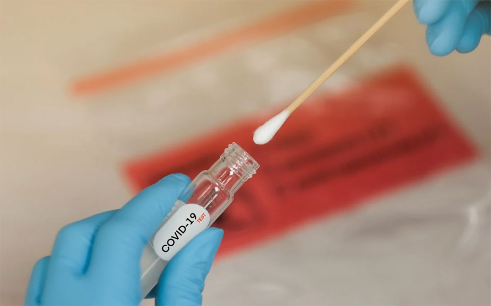 Анализы на COVID-19 Анализы на COVID-19 можно сдать в рамках договора страхования