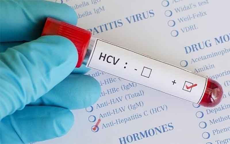 Роспотребнадзор установил источник вирусного гепатита А в Челябинской области 